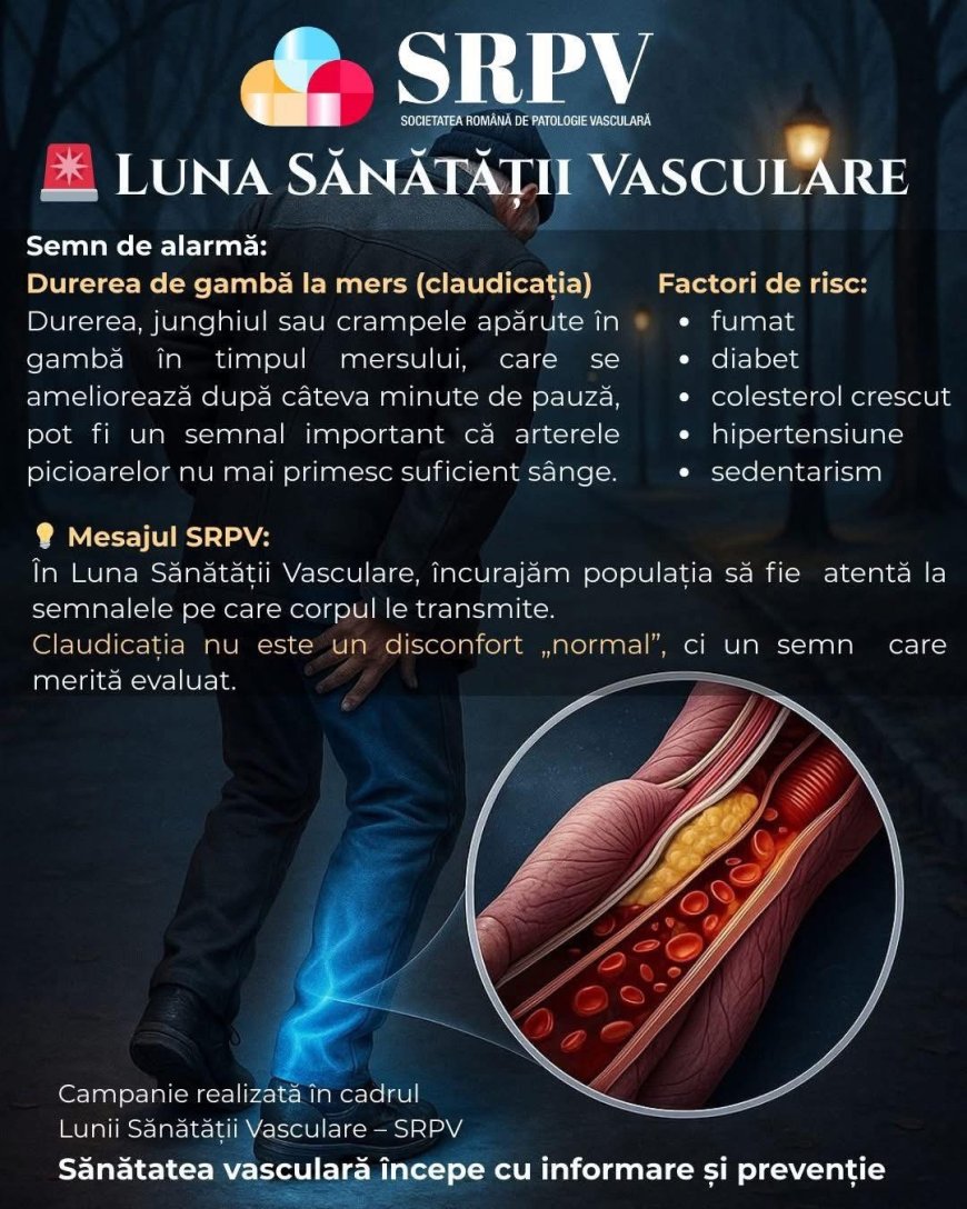 Gambe dureroase la mers? Arterele tale sunt în pericol