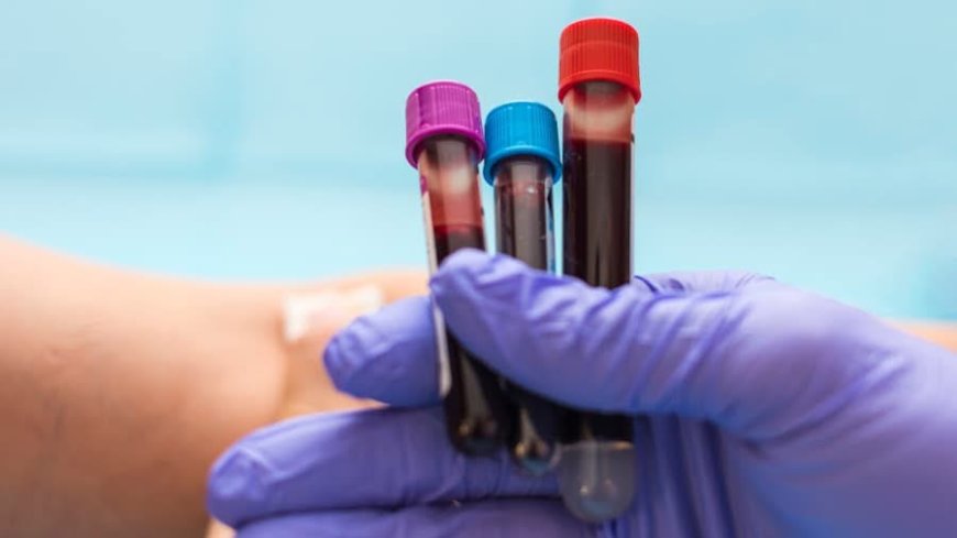 ANALIZE MEDICALE GRATUITE, LA ÎNCEPUT DE AN