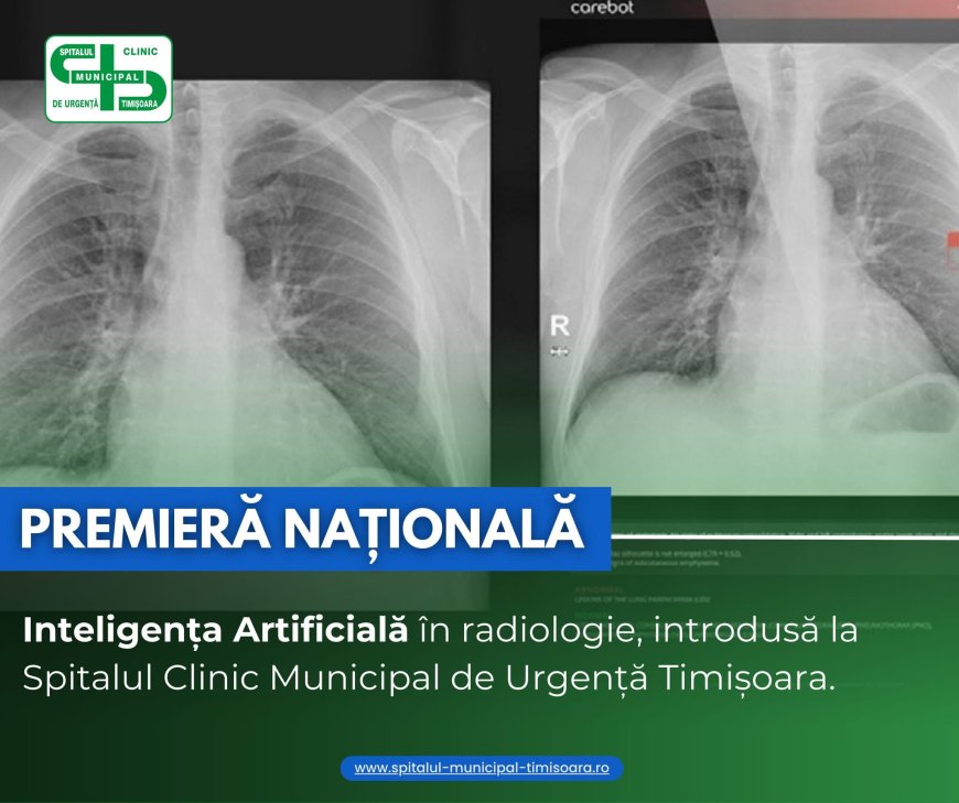 Premieră națională în radiologie la Spitalul Municipal Timișoara