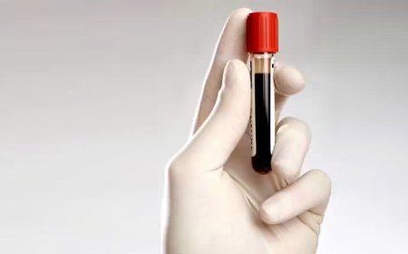 Analiza care ajută la diagnosticarea prediabetului
